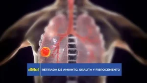 Amianto enfermedad