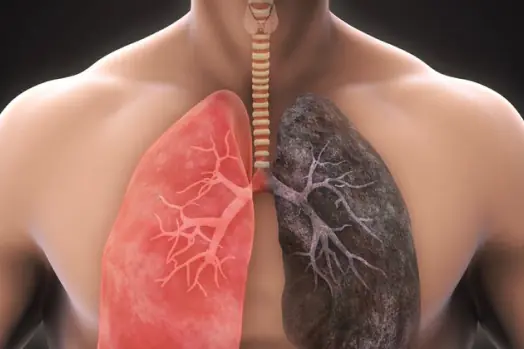 El amianto es peligroso para tu cuerpo si te expones mucho El amianto es peligroso para tu cuerpo si te expones mucho